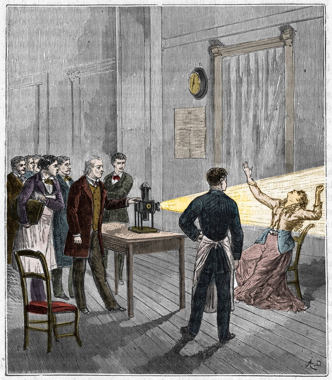 Valon vaikutuksen alaisena syntynyt katalepsia - Ranskalainen neurologi Jean Martin Charcot (1825-1893) tutkii hypnoosin ilmiötä potilaalla Salpetrieren sairaalassa taikalyhdyn avulla - Katalepsia - Jean Martin Charcot (1825-1893), ranskalainen neu tekijältä French School