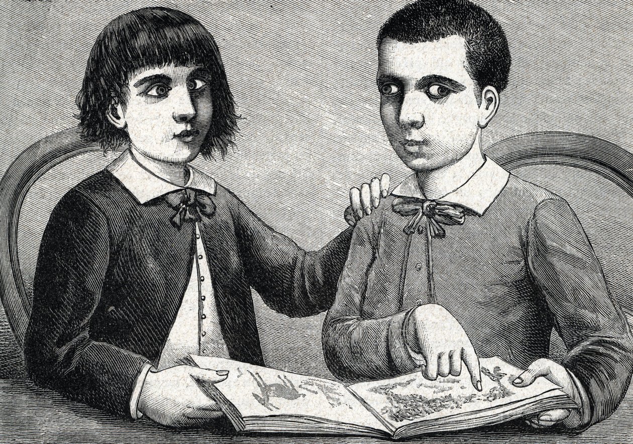 Lapset, joilla on konvergentti ja poikkeava strabismus tai ristissä olevat silmät (kaiverrus) 1888 tekijältä French School