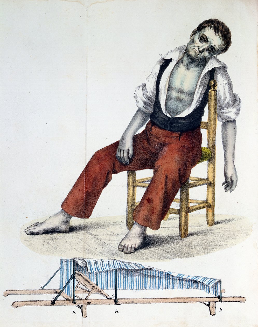 Cholera Morbus, Francisco dAssis de Souza Vazin teoksesta Cholera-Morbusin suhteet, historia, tilastot ja lääketiede, 1833 tekijältä French School