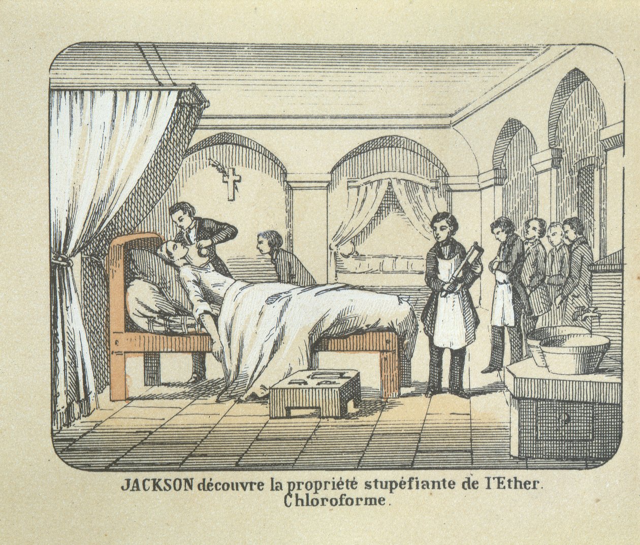 Tohtori Charles Jackson (1805-80) löytää eetterin anesteettiset ominaisuudet tekijältä French School