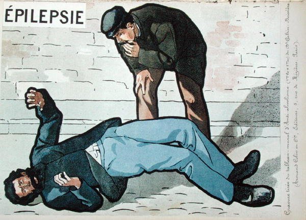 "Akuutin alkoholismin aiheuttama epilepsiakohtaus", tohtori Galtier-Boissieren seinäkuva alkoholismin vaaroista, 1800-luvun loppu. (väri lito) tekijältä French School