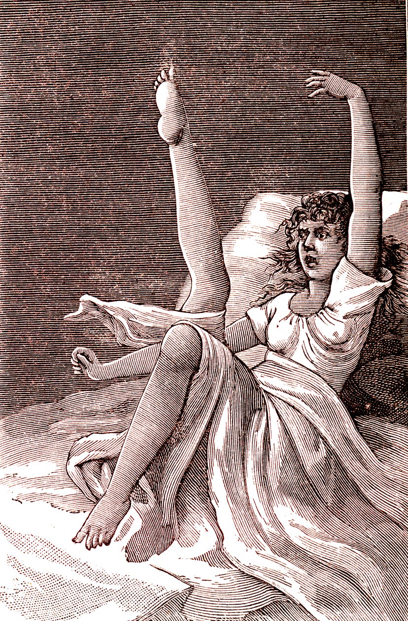 Hysteria, äärimmäisen henkinen ilmiö, psykoosit ja psykoneuroosi.1887 (kaiverrus) tekijältä French School