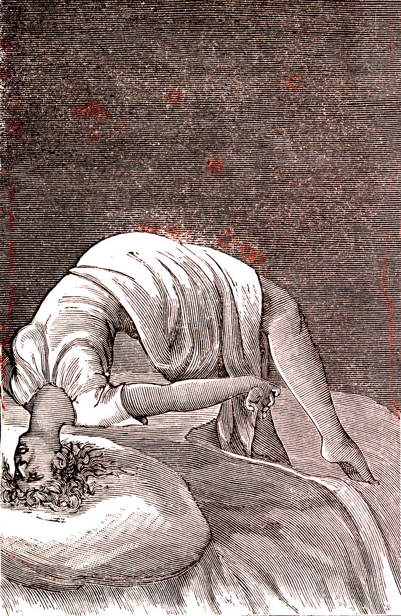 Hysteria, mielenterveyden ja hermoston häiriö, joka johtuu voimakkaasta ahdistuksesta. 1887 (kaiverrus) tekijältä French School
