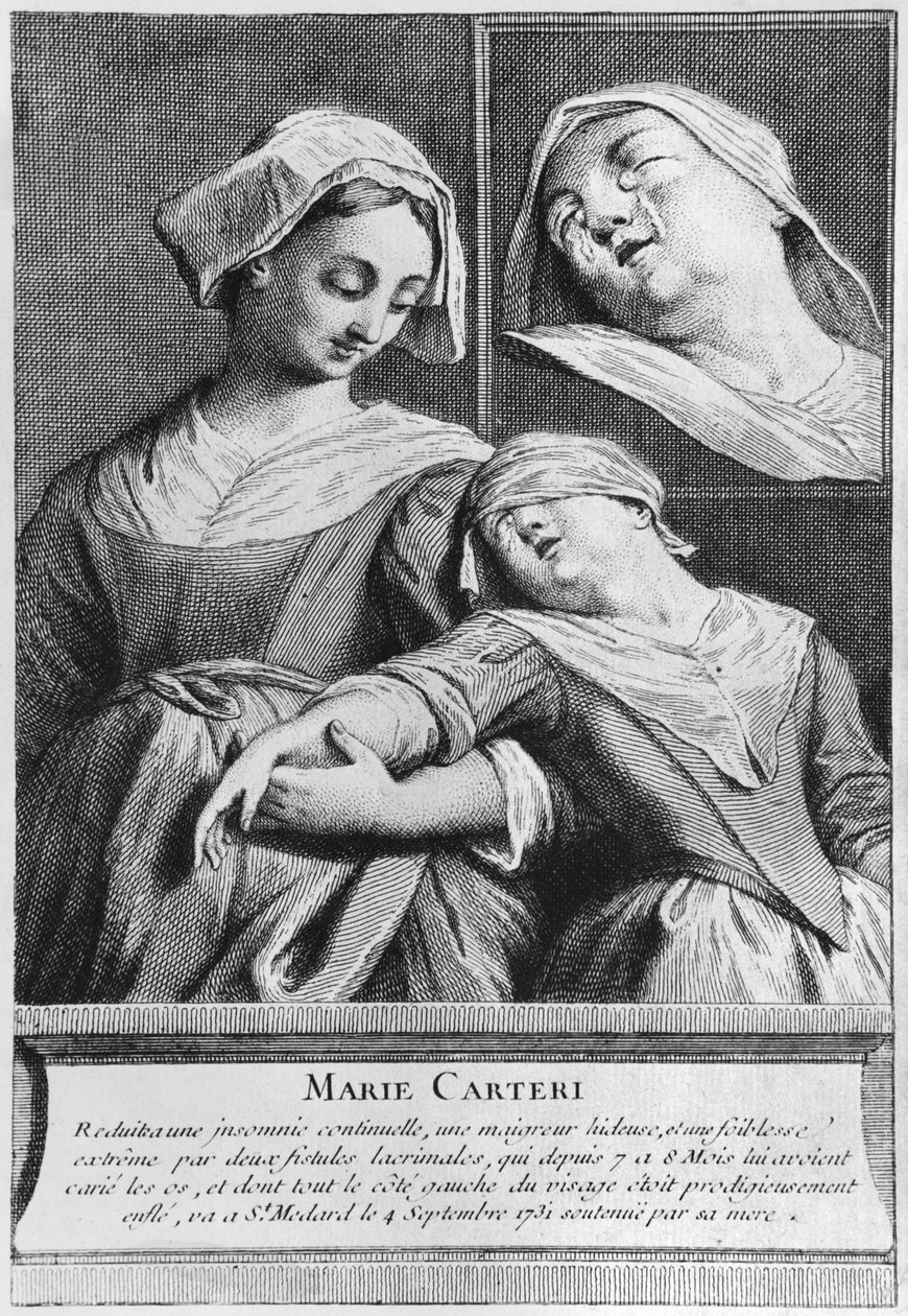 Sokean naisen Marie Carterin ihmeparantuminen diakoni Francois de Parisin haudalla Saint-Medardin seurakunnan hautausmaalla Pariisissa tekijältä French School