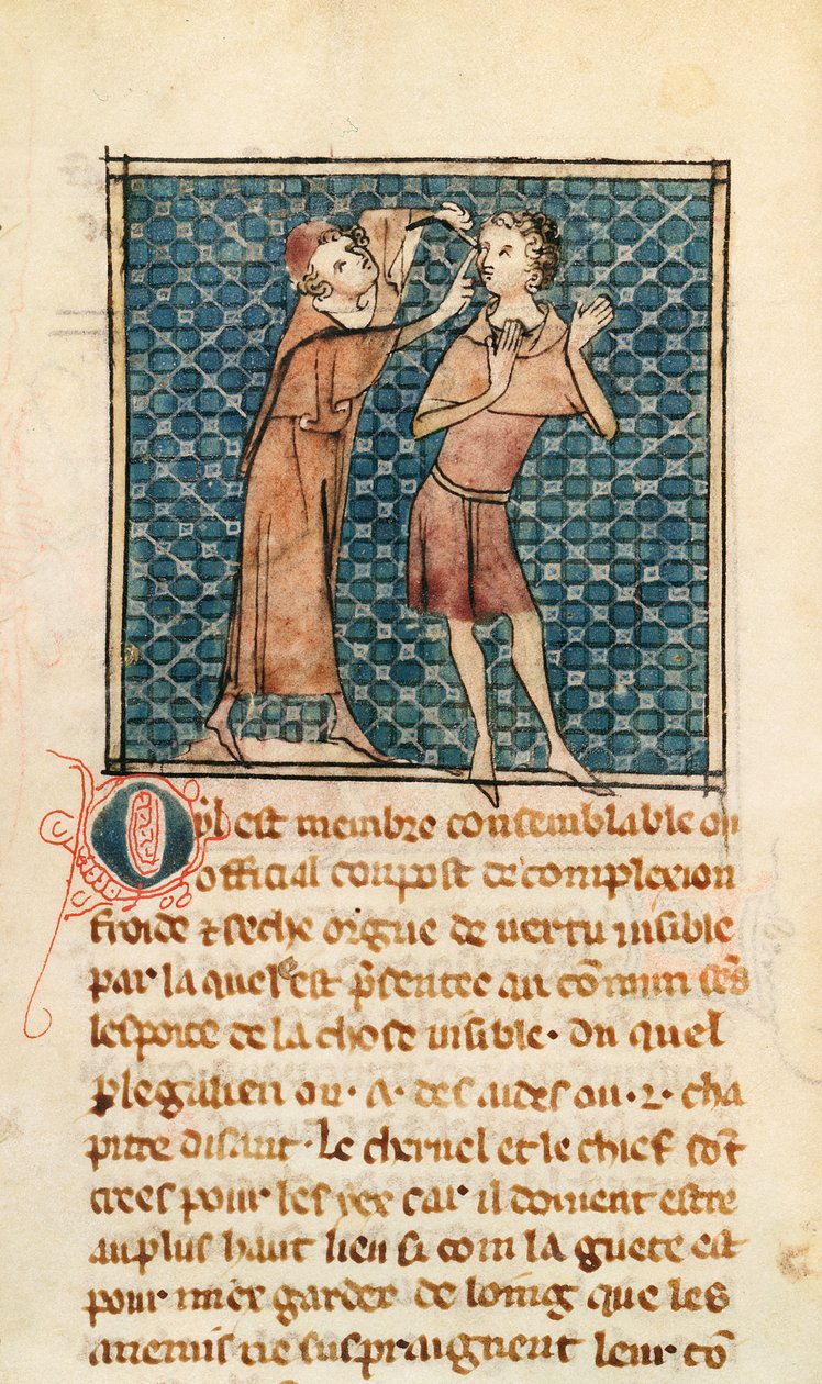 Ms 2030 fol.17 Oftalmologia, kuvitus La Chirurgie de Maitre Henri de Mondevillestä tekijältä French School