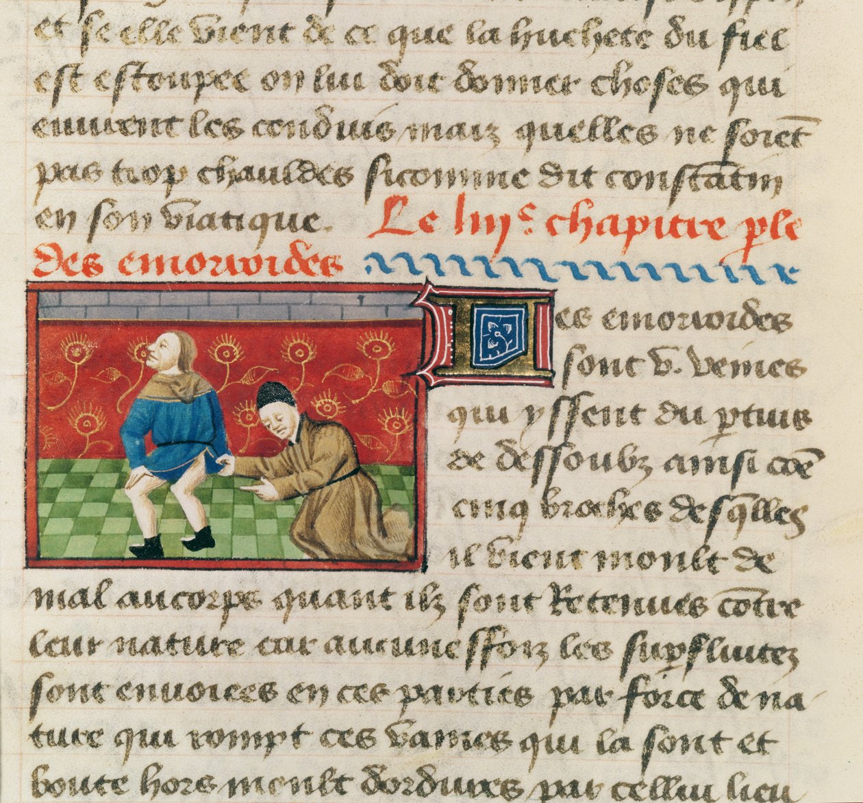 Ms 22532 Peräpukamia sairastavan potilaan tutkimus, Le Livre des Proprietes des Choses, Barthelemy lAnglais, c. 1410-15 tekijältä French School