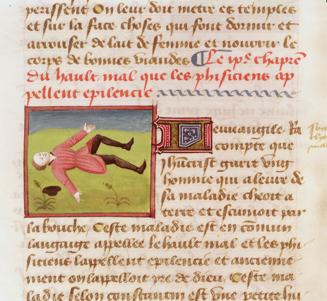 Ms 22532 Potilas, joka kärsii epilepsiakohtauksesta, Barthelemy langlaisin teoksesta The Book of the Properties of Things, c. 1410-15 tekijältä French School