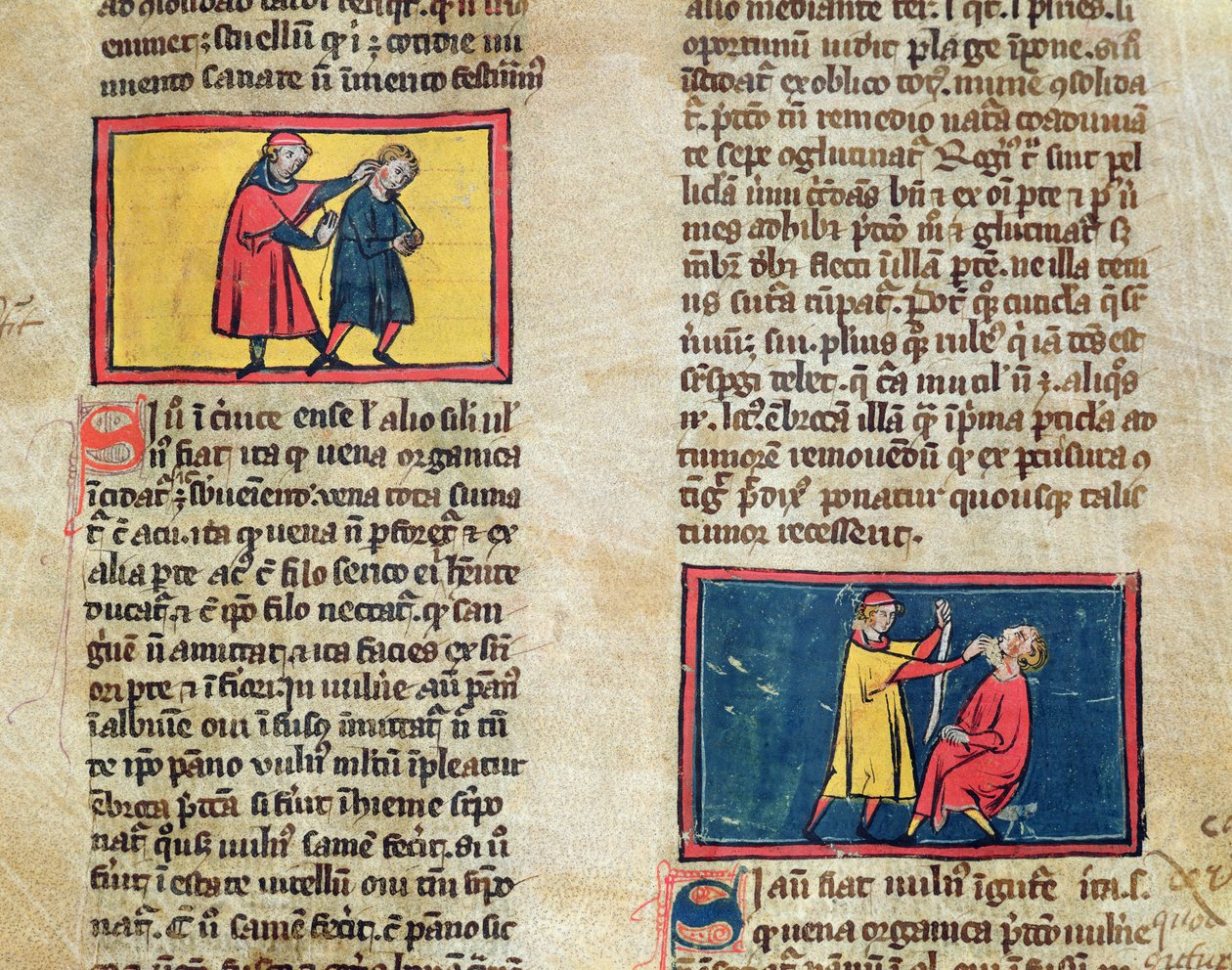 Ms H 89 lääkärit ja potilaat Rogier de Salernen kirjasta Book of Surgery tekijältä French School
