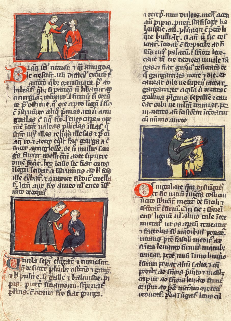 Ms H 89 fol.16v Dental Surgery, Rogier de Salernen 