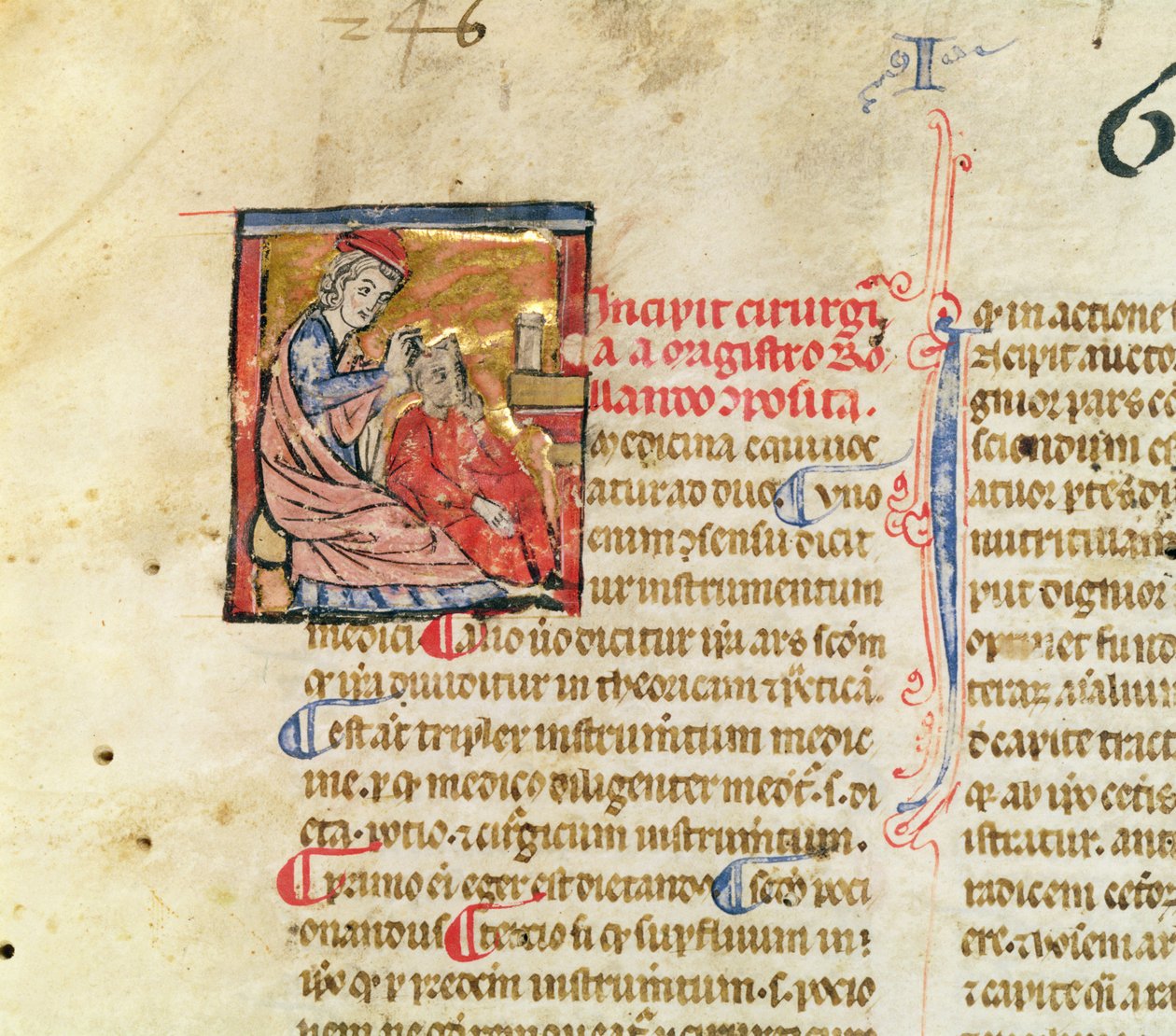 neiti Lat. 7134 fol.1 Trepanaatio, Leikkauksesta Maitre Rolandi tekijältä French School
