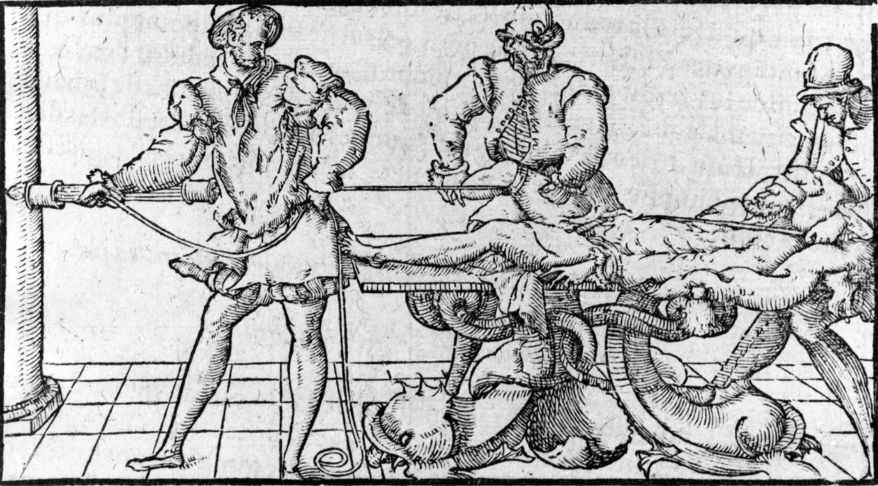 Dislokaatioiden vähentäminen, "Ambroise Parén lääketieteellinen sopimus", noin 1560. tekijältä French School