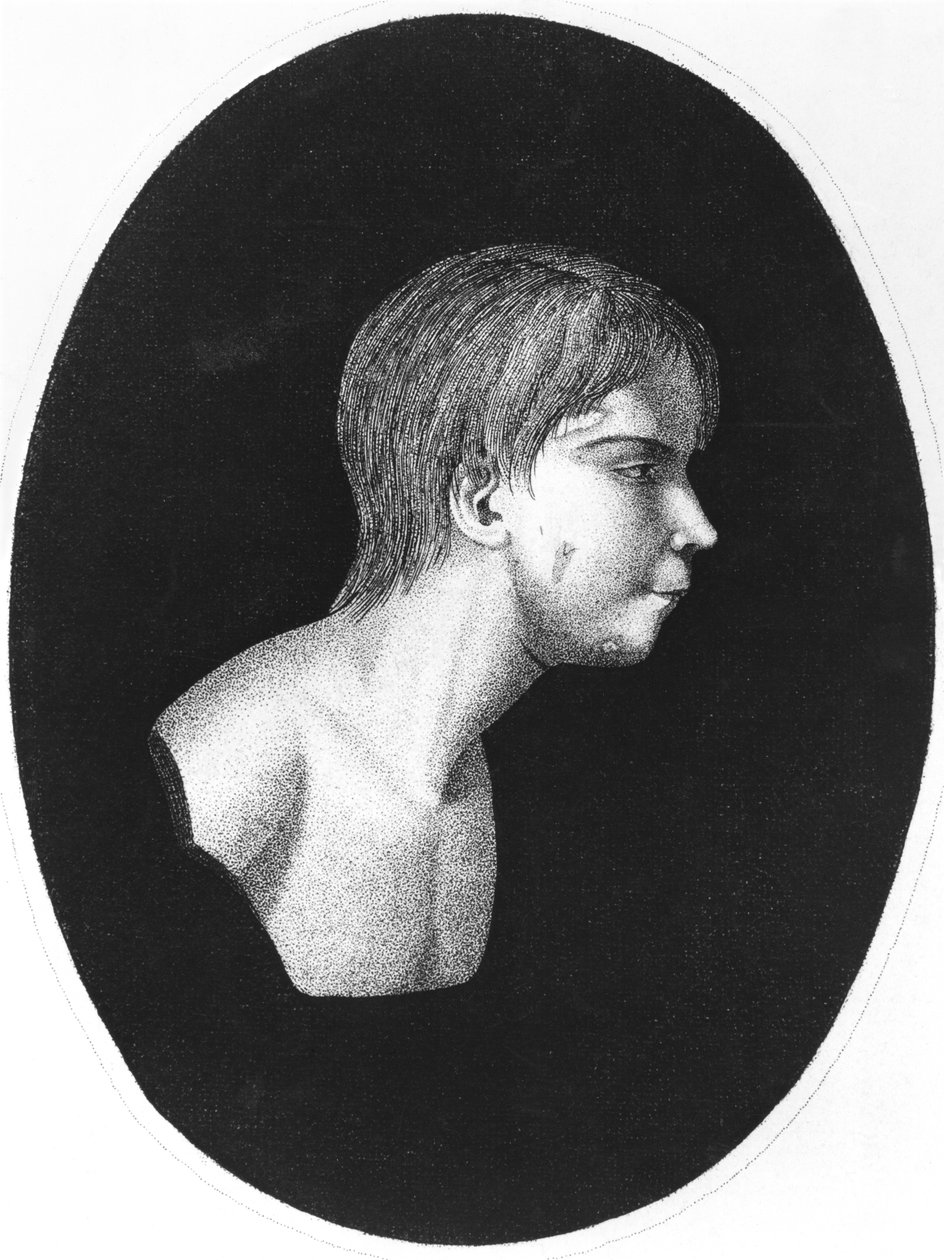 Victor of Aveyron, J.E.Itardin De lEducation dun homme sauvagen etukappale tekijältä French School