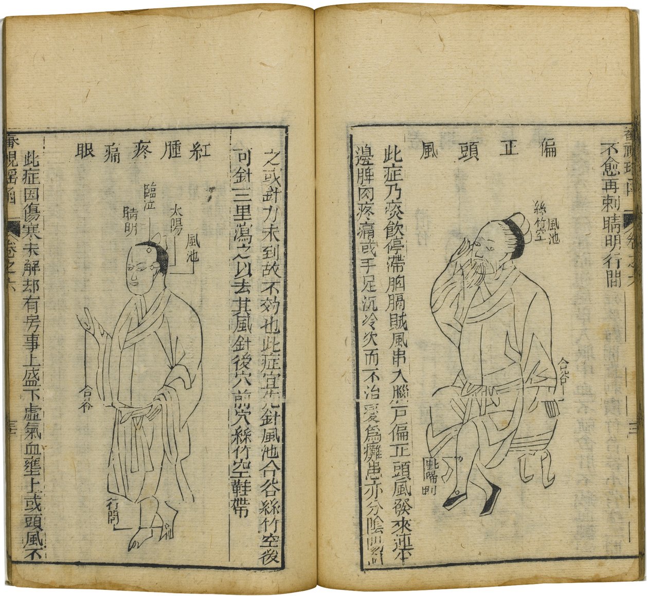 Shen Shi Yao Han Arvokas oftalmologian kirja, 1644 tekijältä Fu Renyu