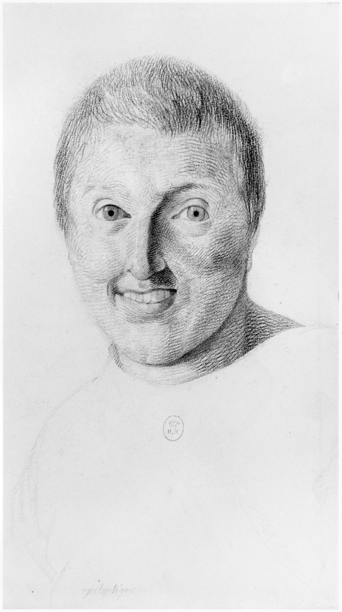 Epileptinen nainen, kuva edestä, kuvitus Jean Etienne Dominique Esquirolin (1772-1840) julkaisemattomasta tutkielmasta Salpetrieren turvapaikan hulluista, n. 1818 tekijältä Georges Francois Gabriel