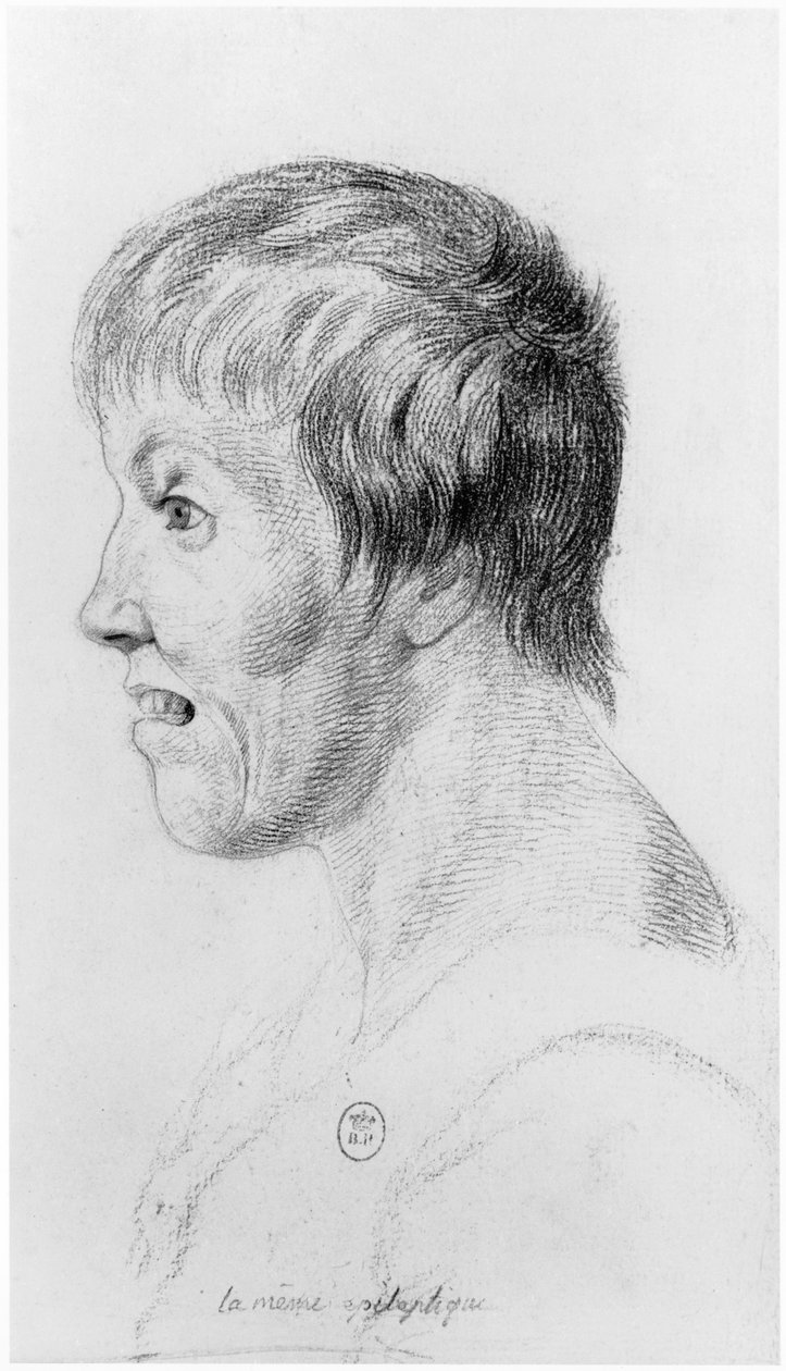 Epilepsiaa sairastava nainen, profiili, kuvitus Jean Etienne Dominique Esquirolin (1772-1840) julkaisemattomasta Salpetrieren mielisairaalan hulluja käsittelevästä tutkielmasta, noin 1818. tekijältä Georges Francois Gabriel