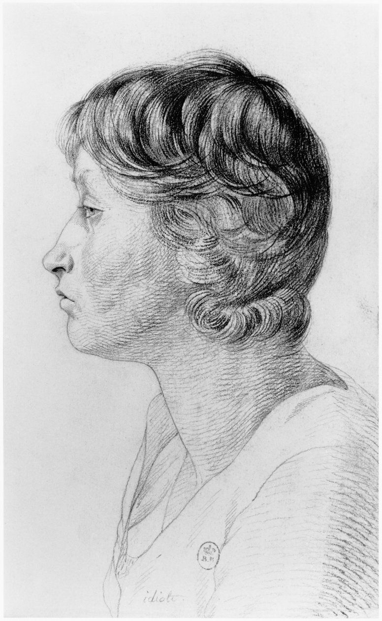 Idiootti, kuvitus Jean Etienne Dominique Esquirolin (1772-1840) julkaisemattomasta tutkielmasta Salpetrieren turvapaikan hulluista, n. 1818 tekijältä Georges Francois Gabriel