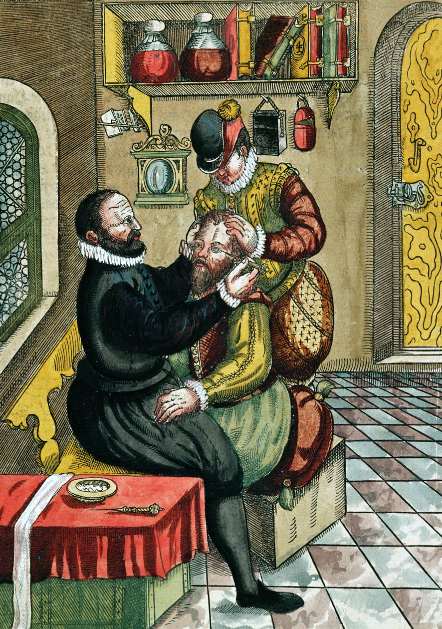 Kaihileikkaus, Georg Bartischin (1535-1636) Ophthalmodouleiasta, julkaistu Dresdenissä vuonna 1583 (värillinen puupainatus) tekijältä German School