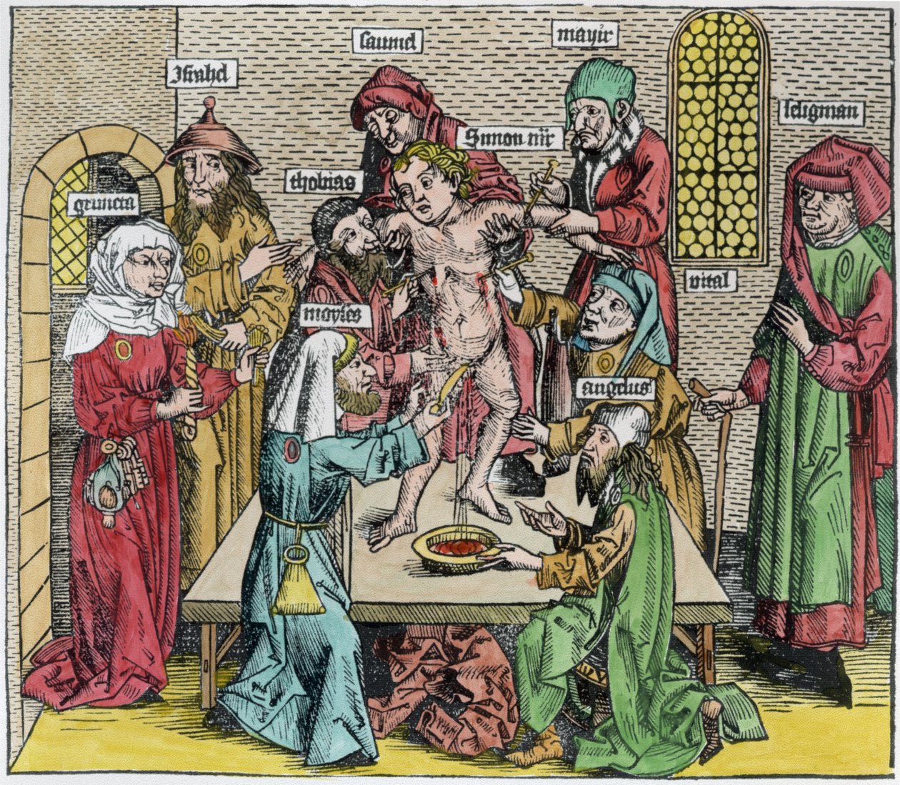 Ympärileikkaus, Hartmann Schedelin (1440-1514) teoksesta "Liber Chronicarum" (myöhempi väritys) tekijältä German School