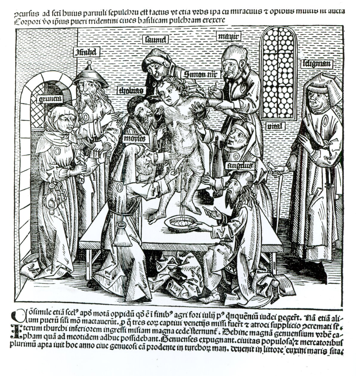 Ympärileikkaus, Hartmann Schedelin (1440-1514) teoksesta "Liber Chronicarum" tekijältä German School