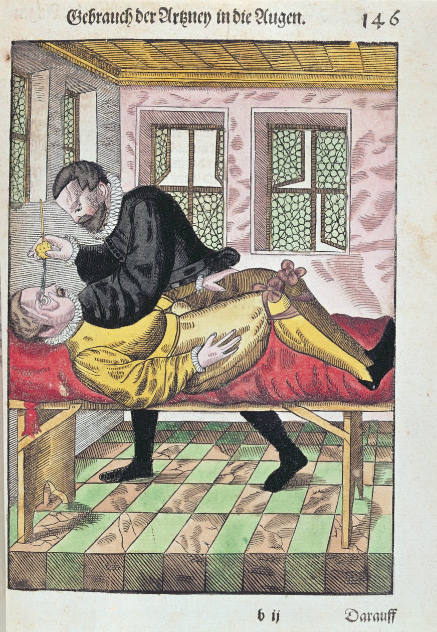 Eye Operation, Georg Bartischin (1535-1636) Ophthalmodouleiasta, julkaistu Dresdenissä vuonna 1583 (värillinen puupainatus) tekijältä German School