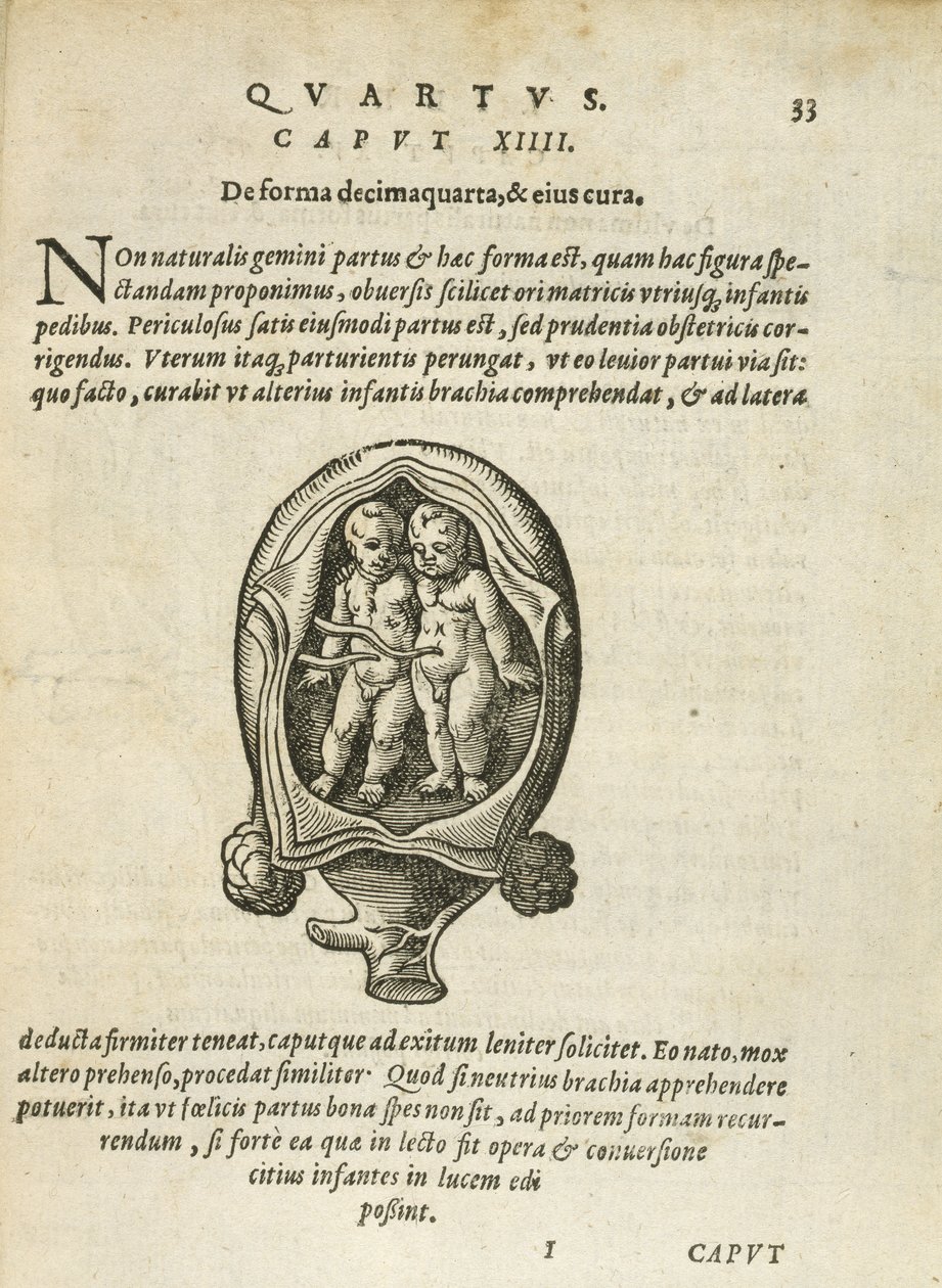 Ei-identtiset kaksoset kohdussa, kuvitus Rueffin 1587:n kirjan 4. luvusta Ihmisen sikiämisestä ja kasvusta. tekijältä German School