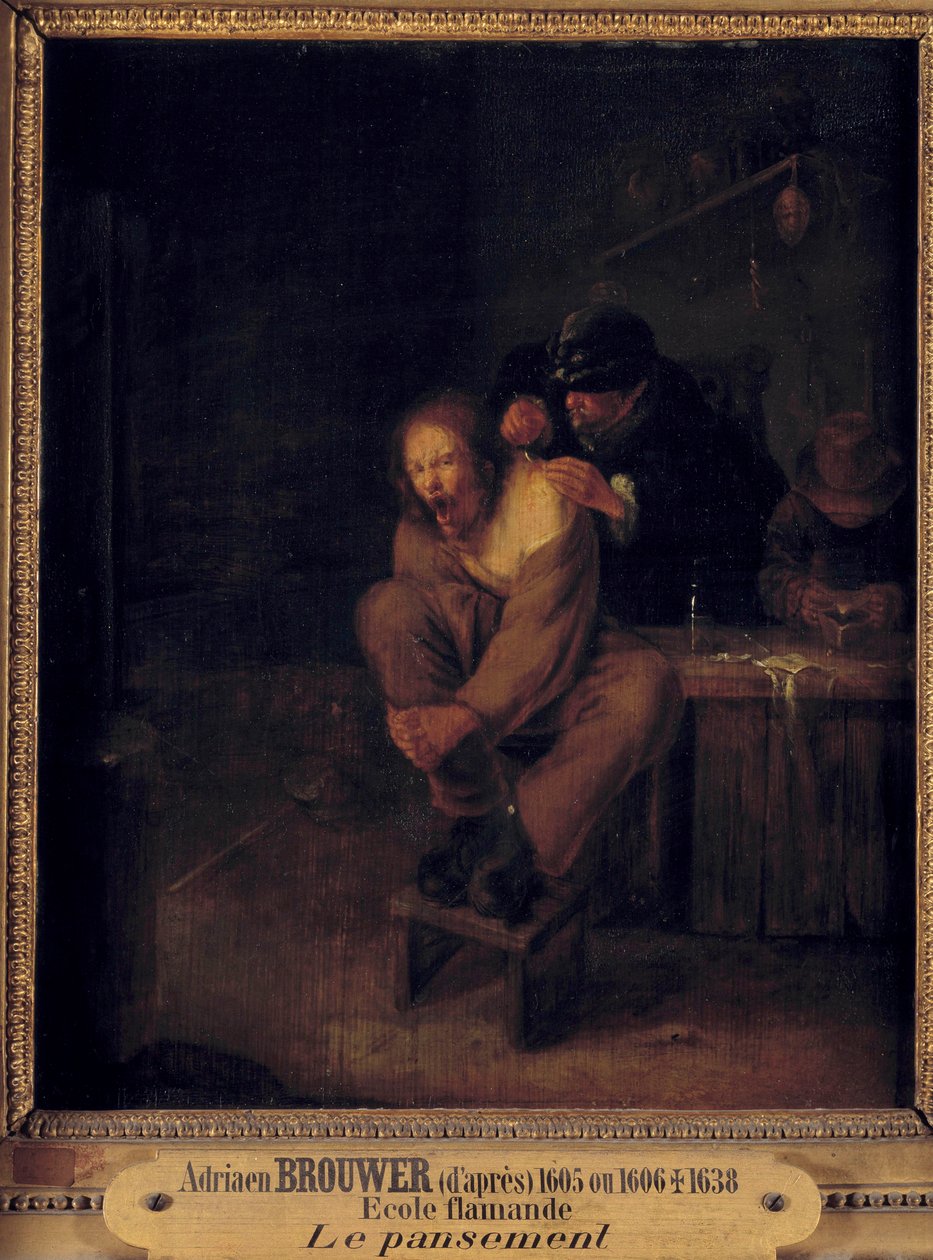 Leikkaus (tai sidos) Potilasta hoitava kirurgi. Gerrit Lundensin (1622-1683) maalaus Adriaen Brouwerin (1605/1606-1638) mukaan. 17. vuosisata. Himmeä. 0,32x0,28 m. tekijältä Gerrit Lundens