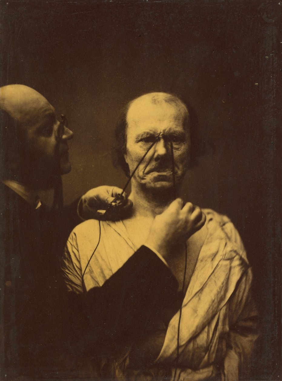 Aggressio, pahuus,1854-1856, painettu 1862 (kuva). tekijältä Guillaume-Benjamin-Armand Duchenne de Boulogne