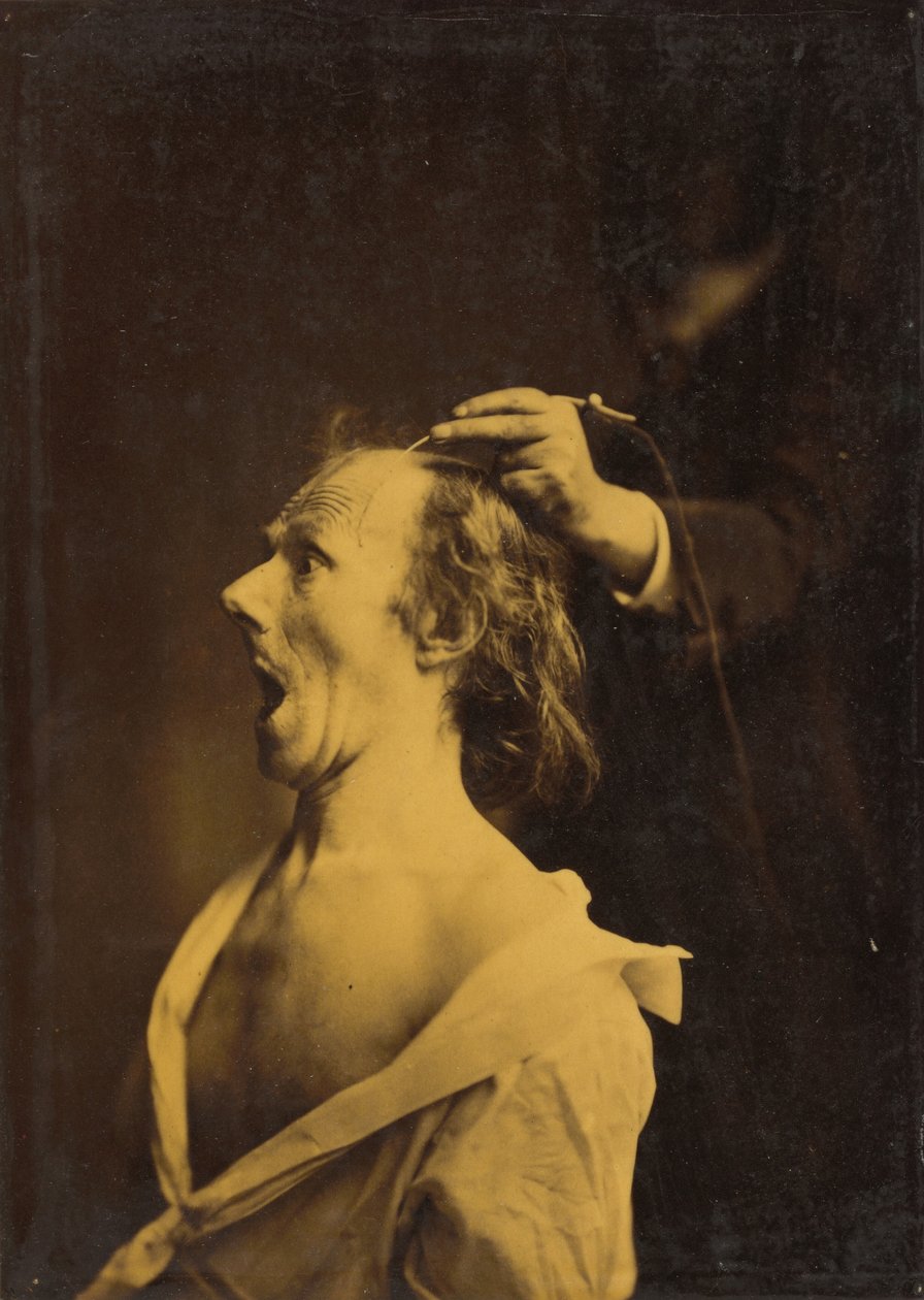 Hämmästys, tyrmistys, hämmästys,1854-1856, painettu 1862 (kuva) tekijältä Guillaume Benjamin Armand Duchenne de Boulogne
