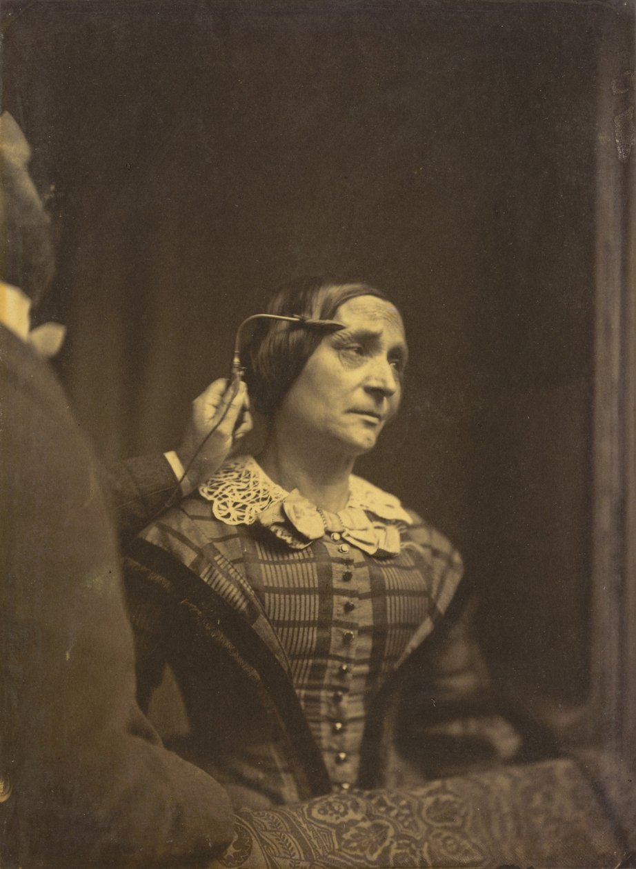 Huomio, tarkkaava katse (vasen); tuskallinen huomio (oikea),1854-1856, painettu 1862 (kuva). tekijältä Guillaume Benjamin Armand Duchenne de Boulogne