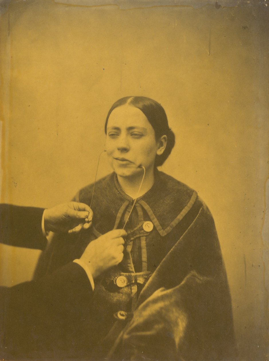 Halveksuva inho (vasemmalla); halventava nauru (oikealla),1854-1856, painettu 1862 (kuva). tekijältä Guillaume Benjamin Armand Duchenne de Boulogne