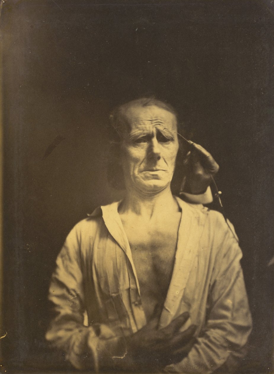 M. corrugator supercilii -lihaksen kouristus erittäin voimakkaassa valossa (vasemmalla); Rentoutuneet kasvot (kuvattu täydessä auringonpaisteessa) (oikealla).
,1854-1855, painettu 1862 (valokuva). tekijältä Guillaume Benjamin Armand Duchenne de Boulogne