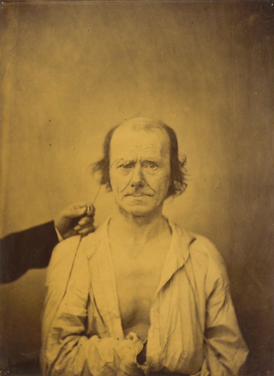 Huomio (vasemmalla); Heijastus (oikealla) tekijältä Guillaume Benjamin Amant Duchenne