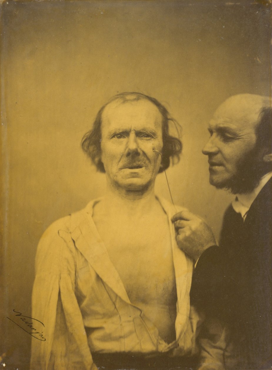 Itku, säälin kyyneleet (vasemmalla); Rento kasvot (oikealla) tekijältä Guillaume Benjamin Amant Duchenne