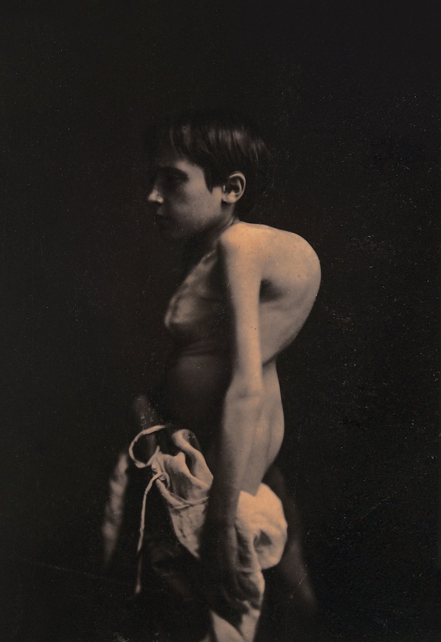 Kypäräpojan muotokuva, n. 1855-57 tekijältä Guillaume Benjamin Armand Duchenne de Boulogne