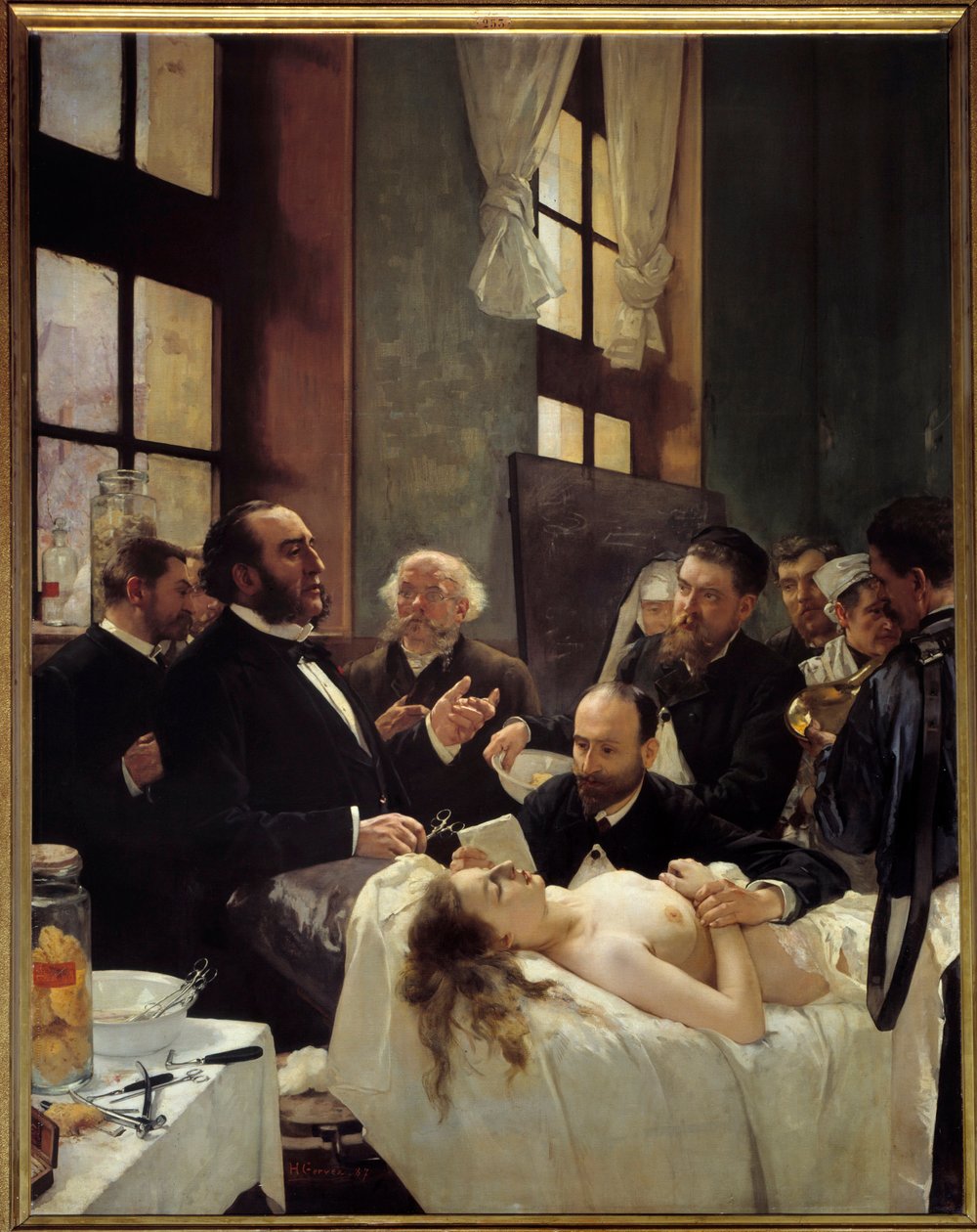 Tohtori Jules Emile (Jules-Emile) Pean (1830-1898) opetti Saint Louisin sairaalassa löytöään laivojen puristamisesta eli "" Ennen leikkausta"" Henri Gervexin (1852-1929) maalaus 1887 su. 2,42 x 1,88 m Pariisi, musee d