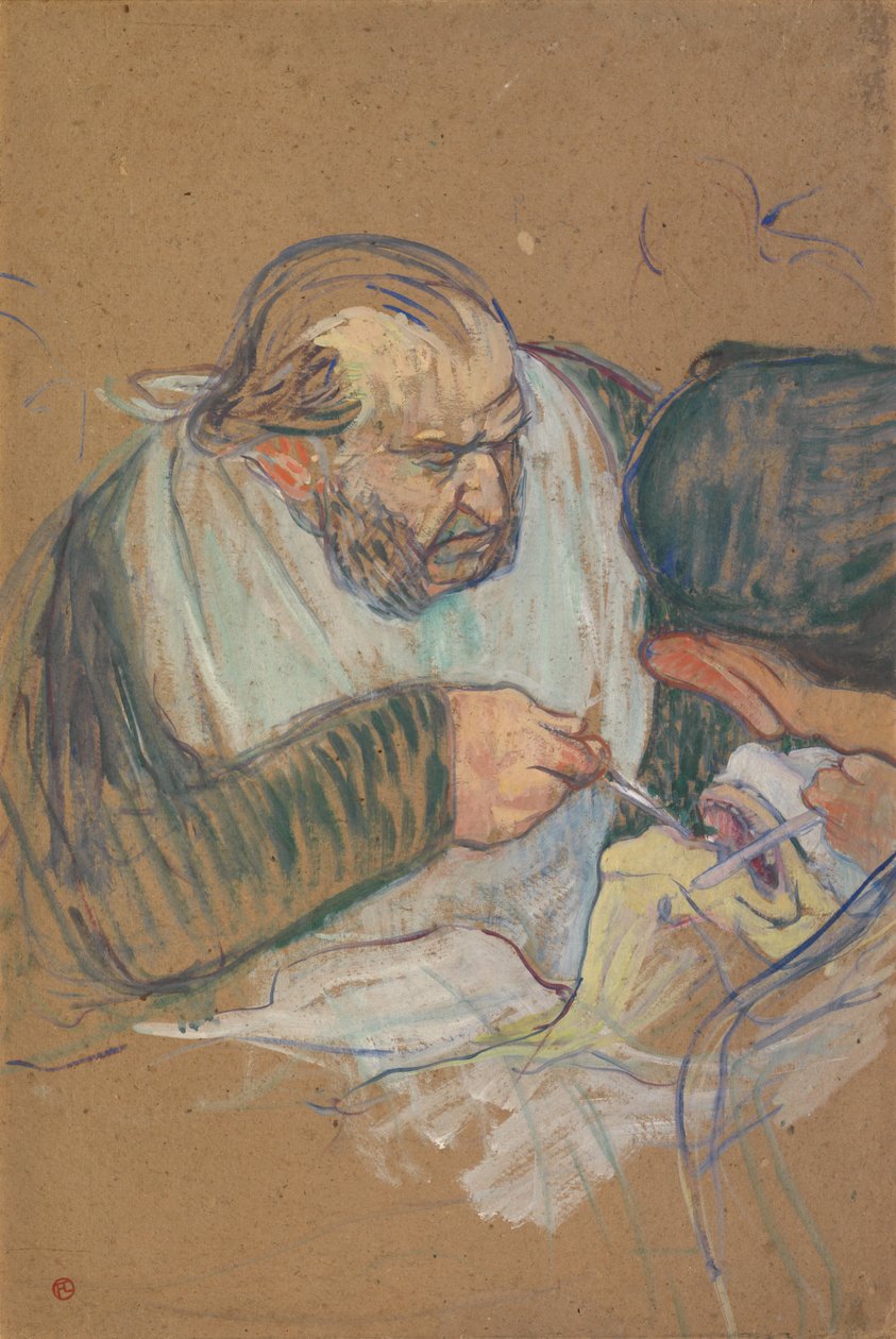 Tohtori Péan leikkaamassa tekijältä Henri de Toulouse-Lautrec