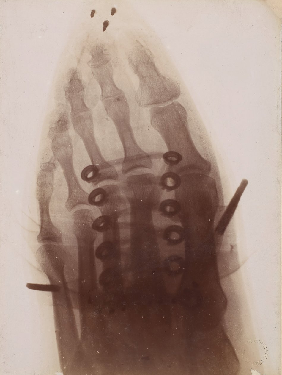 Jalka kengän läpi, 1896. tekijältä Henri van Heurck