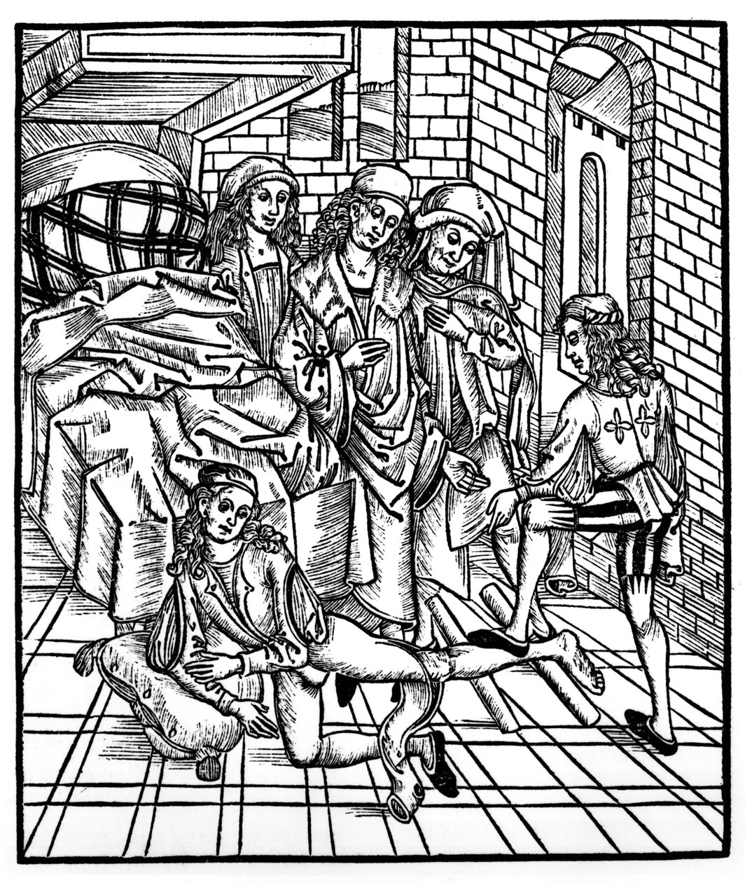 Kirurgi ohjaa assistenttina katkaisee ja nollaa jalkansa, "Das Buch der Cirugia", julkaistu Strasbourgissa, 1497 tekijältä Hieronymus Brunschwig