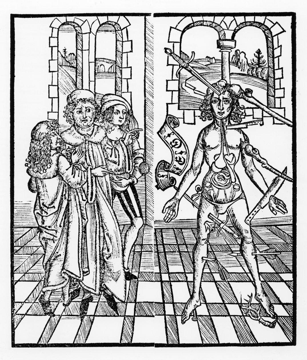 Haavoittunut mies, Das Buch der Cirugia, julkaistu Strasbourgissa, 1497 tekijältä Hieronymus Brunschwig