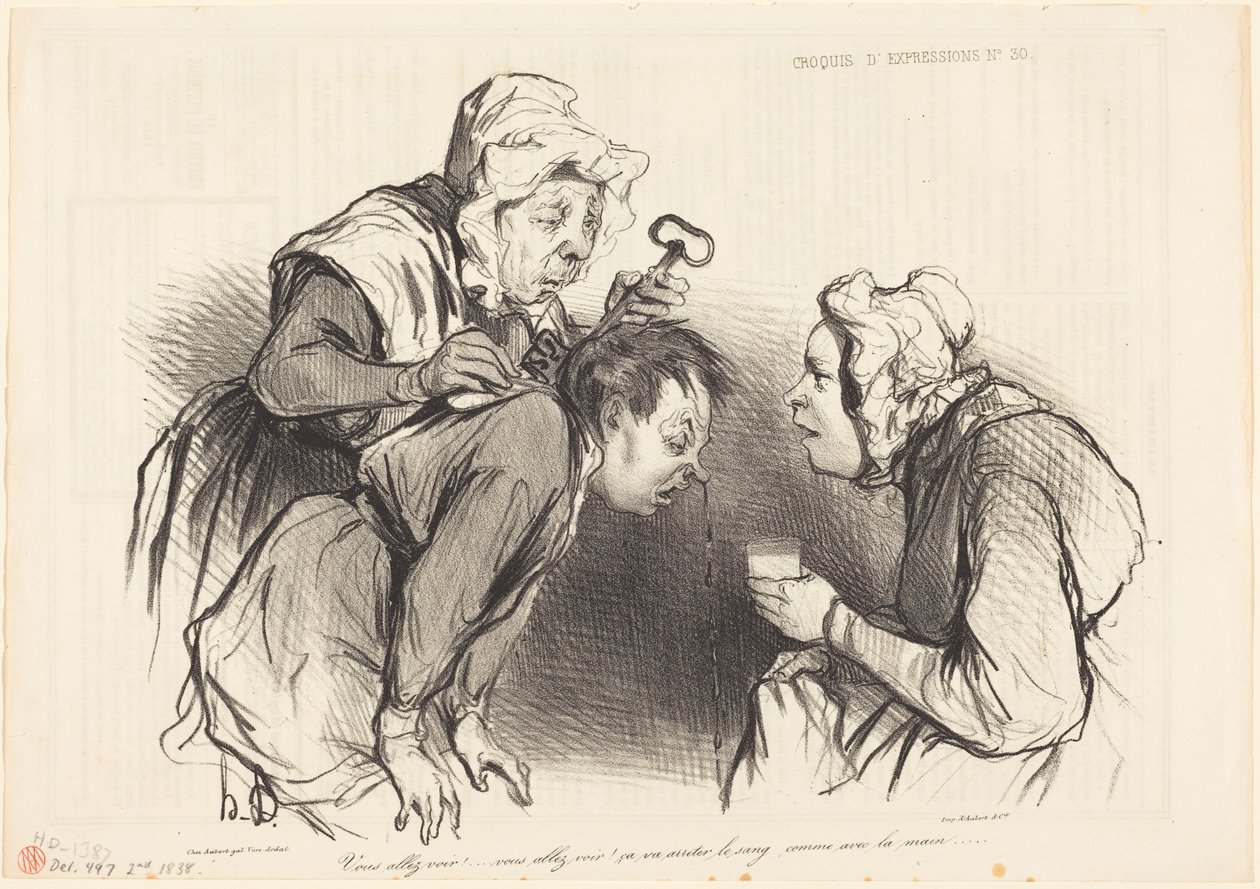Katsokaa vain!... Se pysäyttää verenvuodon... tekijältä Honoré Daumier