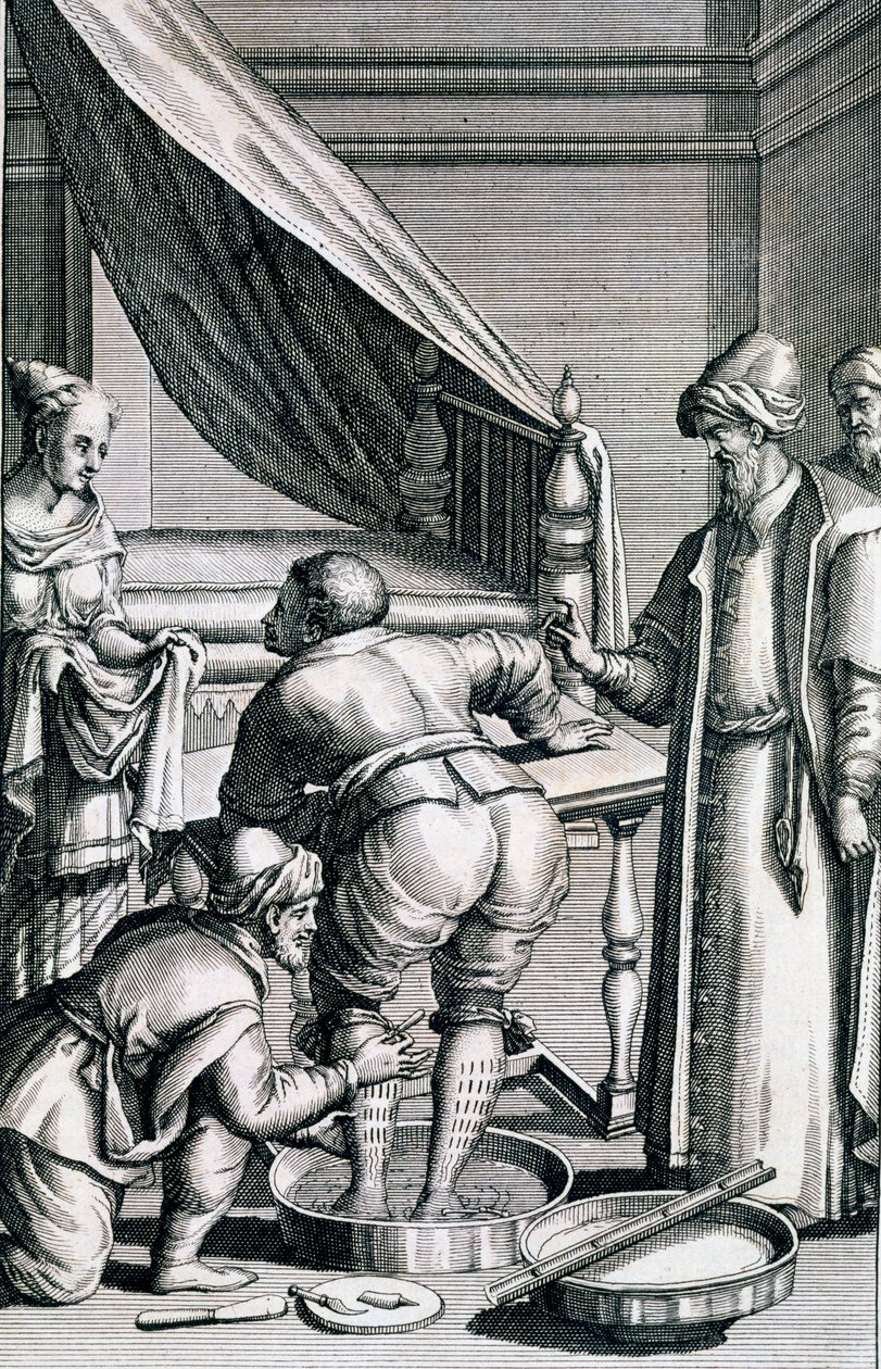 Verenvuoto jaloissa, Prospero Alpinin Medicina Aegyptiorum, julkaistu 1745 tekijältä Italian School
