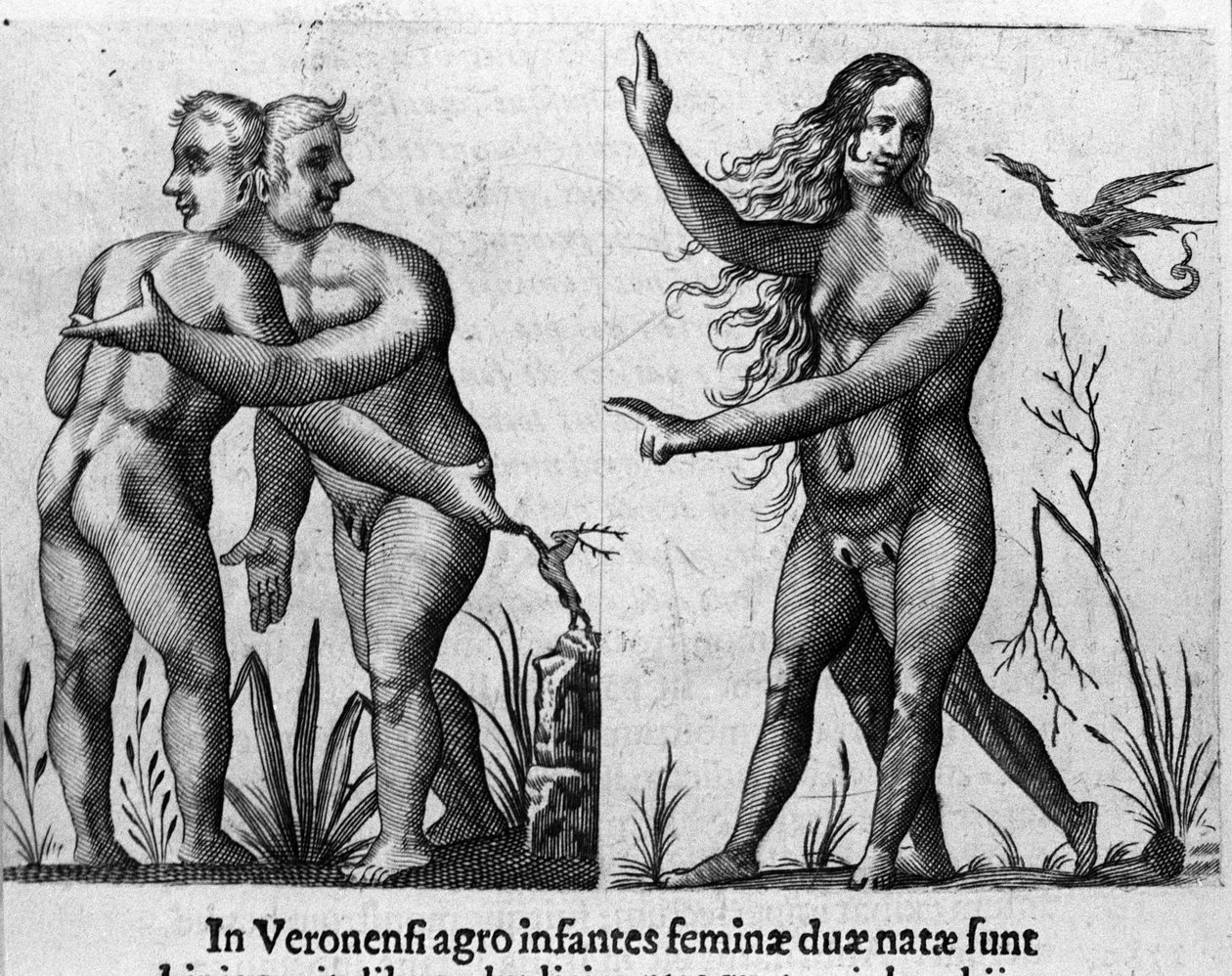 Erilaisia ihmishirviöitä: mies, jolla on kaksoisvartalo ja -pää, ja nainen, jolla on neljä jalkaa ja kaksi sukupuolta. Italian tiedemiehen Fortunio Licetin (1577-1656) kaiverrus "De monstrorum natura, causis et differentiis". 1646 tekijältä Italian School