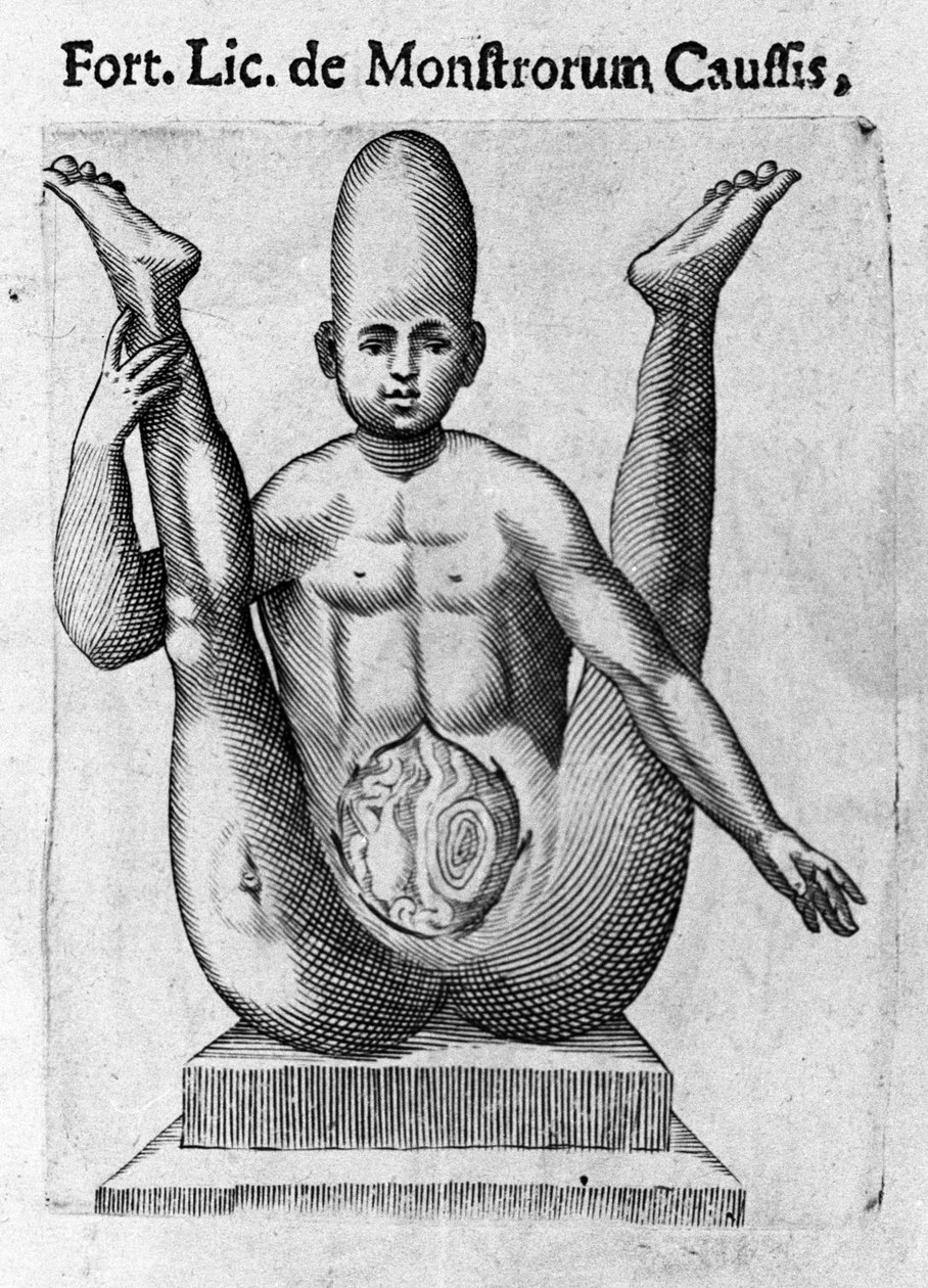 Ihmishirviö: olento, jolla on valtava kallo ja näkyvä suolet. Italian tiedemiehen Fortunio Licetin (1577-1656) kaiverrus "Hirviöiden luonne, syyt ja erot". 1646 tekijältä Italian School
