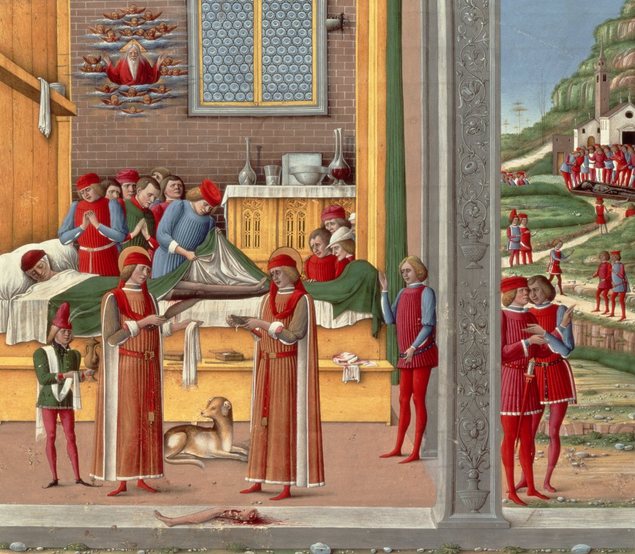 Keskiaikainen amputaatiokohtaus (tempera paneelissa) tekijältä Italian School