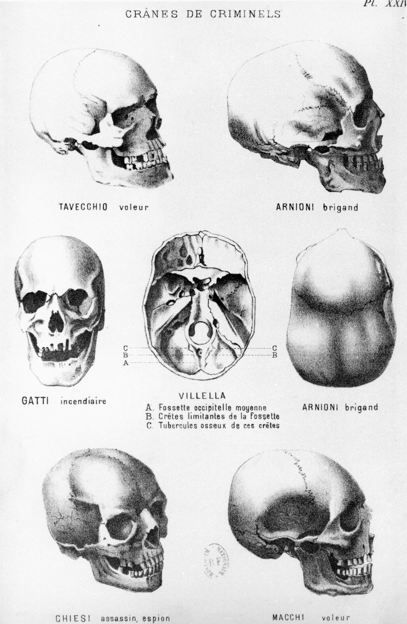 Skulls of Murderers, Cesare Lombroson (1835-1909) LHomme Criminelistä, julkaisija Felix Alcan, 1887 tekijältä Italian School