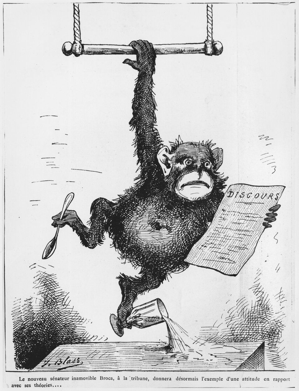 Karikatyyri Paul Brocan (1824-80) kuvituksesta "Le Triboulet", 1880 tekijältä J. Blass