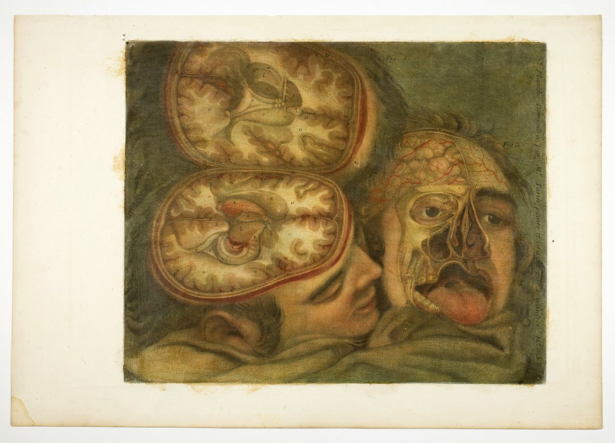 Cranial Dissection, levy viisi teoksesta Anatomy of the Head, in Printed Paintings (pään anatomia, painetut maalaukset) tekijältä Jacques Fabien Gautier d