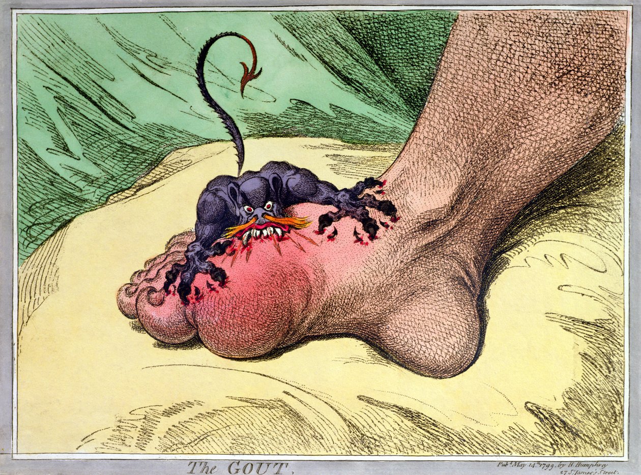 The Gout, julkaissut Hannah Humphrey vuonna 1799 (käsinvärinen softdground-etsaus) tekijältä James Gillray