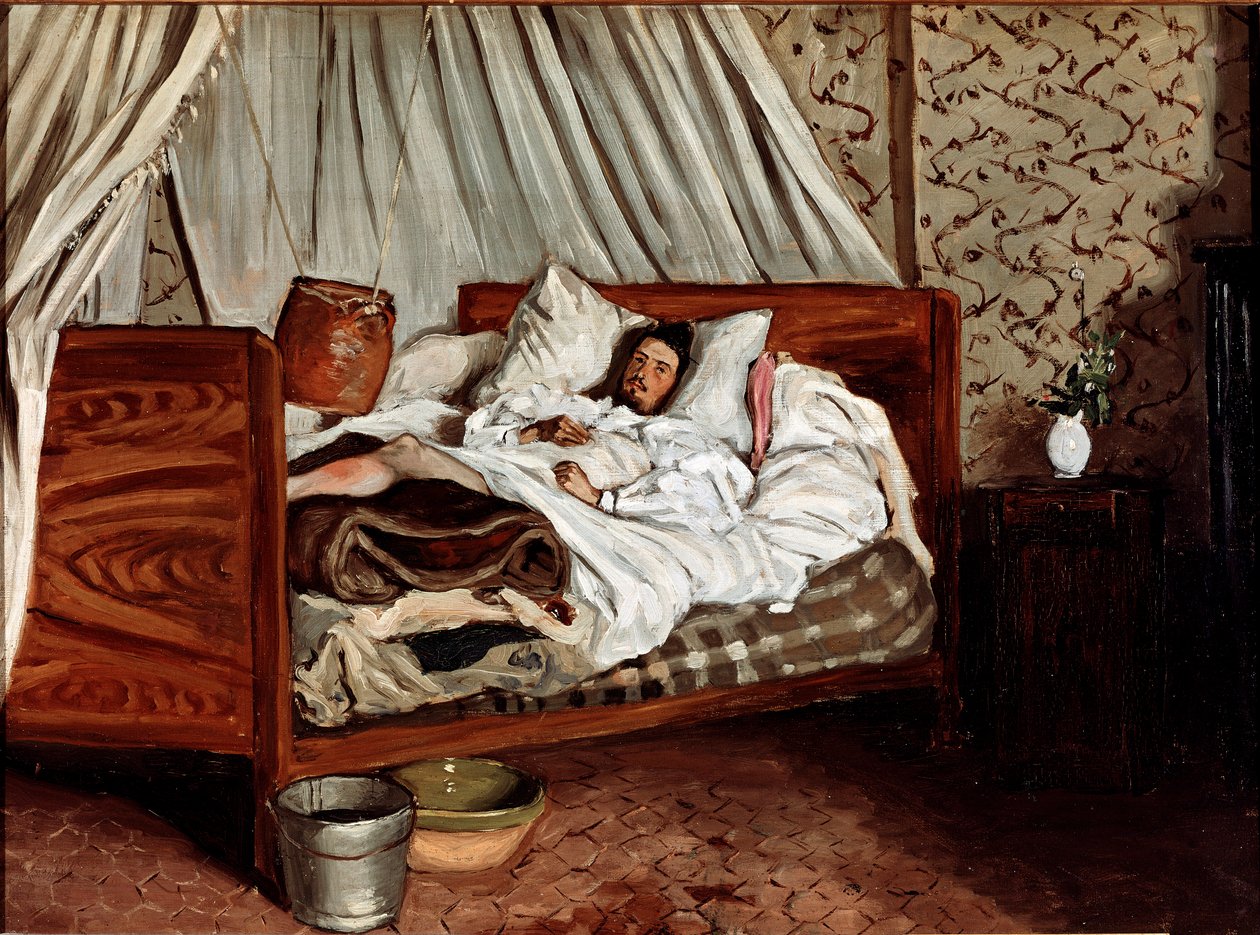 Improvisoitu ambulanssi (Claude Monet haavoja). Jean Frederic Bazillen (1841-1870) maalaus tekijältä Jean Frederic Bazille