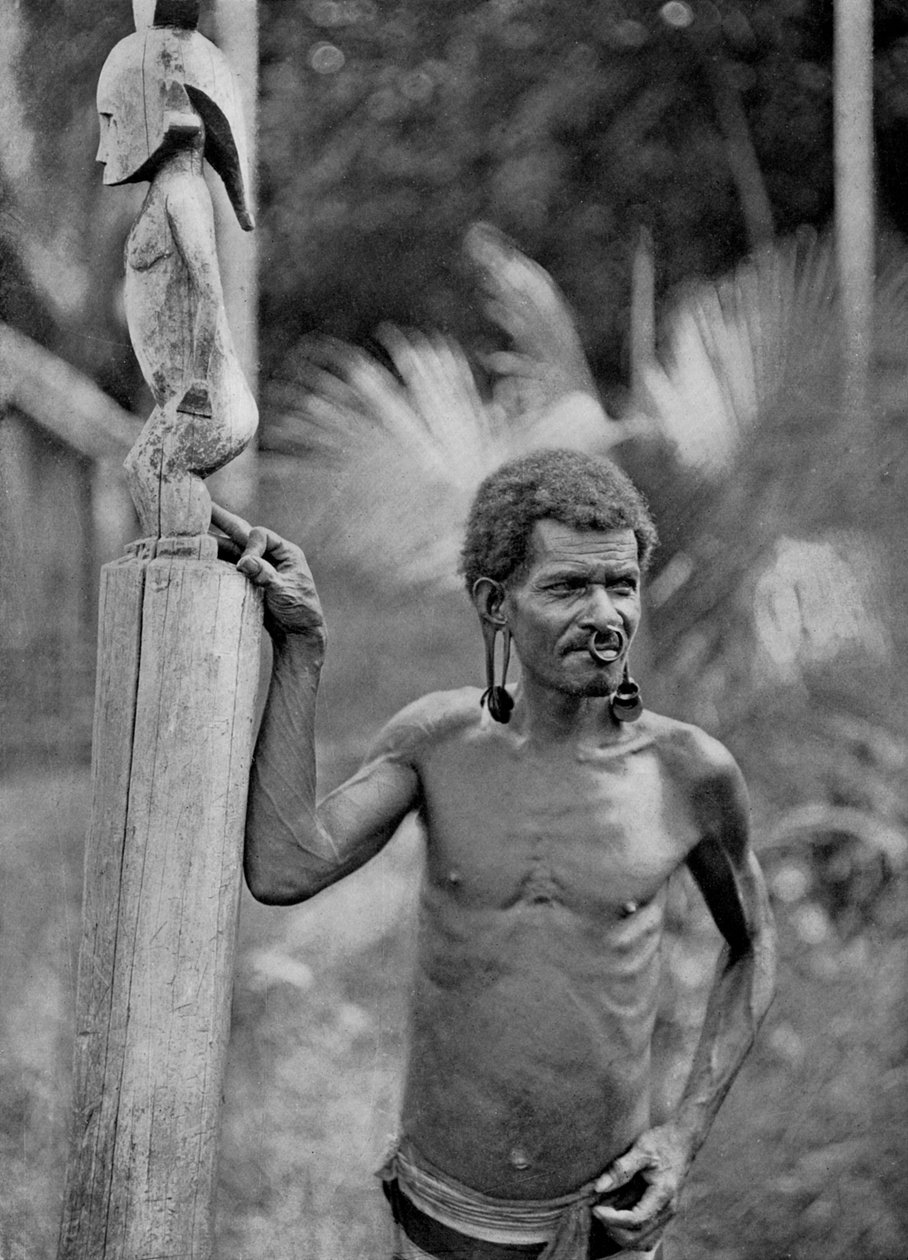Korvien epämuodostuma, Salomonsaaret, 1920. tekijältä John Watt Beattie